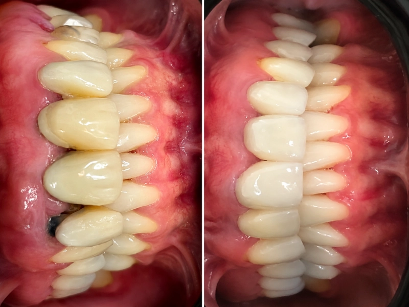 Periodontia